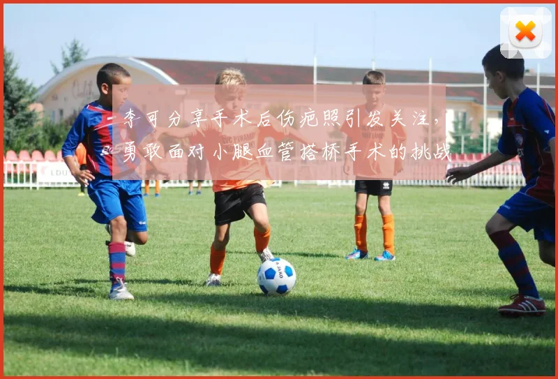 李可分享手术后伤疤照引发关注，勇敢面对小腿血管搭桥手术的挑战